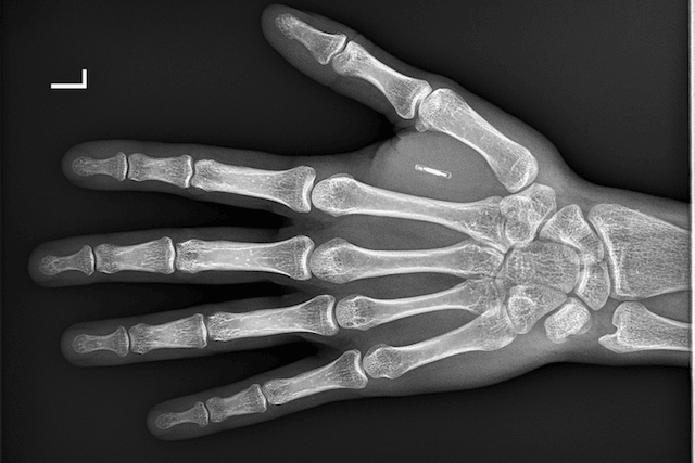 microchip