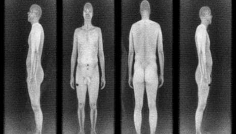 scan-x-ray