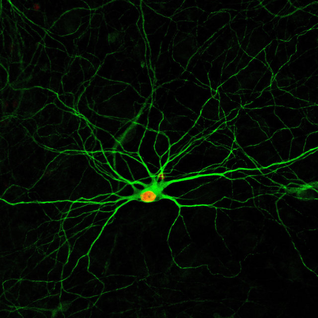 neurons